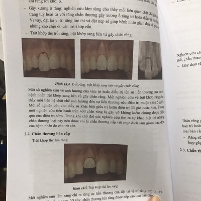 Phẫu thuật miệng II ( NXB Giáo dục )